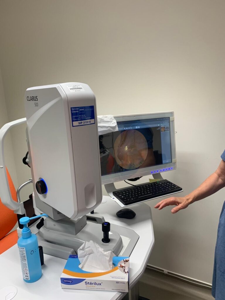 Photo du Clarus 500 de Zeiss
